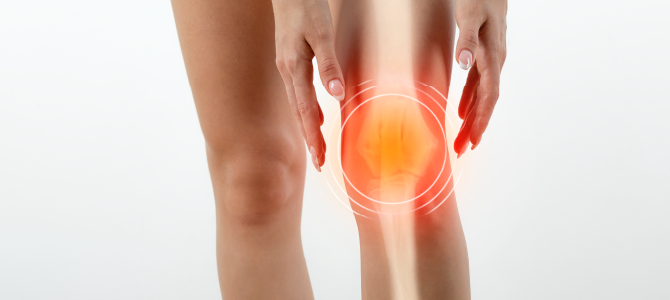 medical image of joint pain
