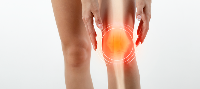 What is Collagen In-Article Image 02 medical image of joint pain