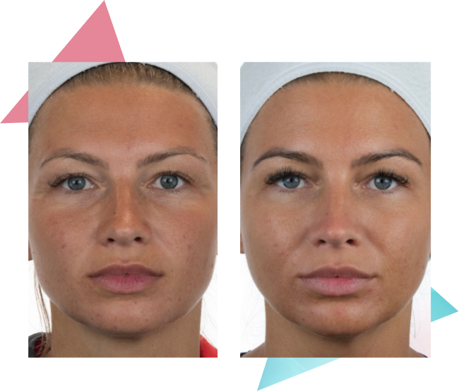 nu-skin-ageloc-boost-editorial-boost-before-after-application.png