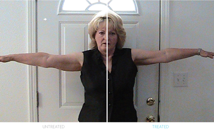 ageLOC_untreated&treated_vickie_thomas