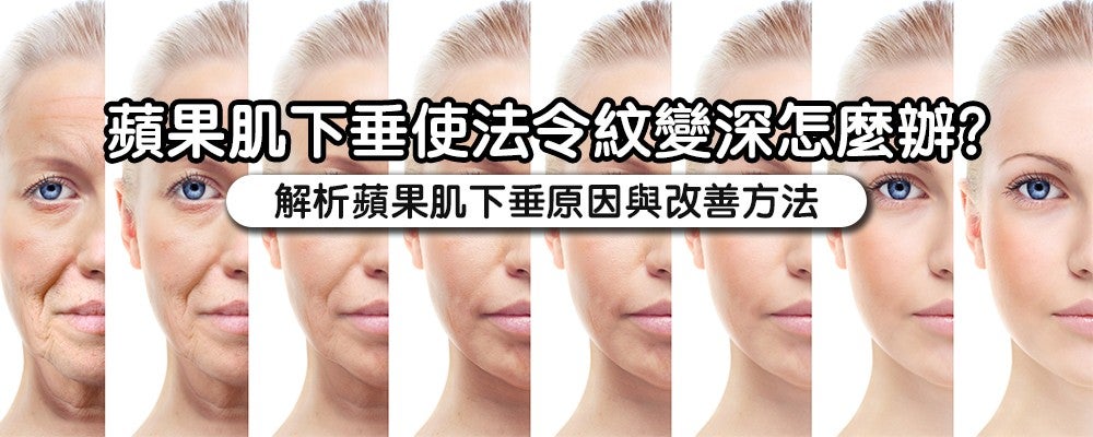 apple_cheeks_banner copy